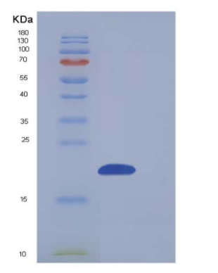 Recombinant Human NUDT2 / Ap4A hydrolase Protein (His tag),Recombinant Human NUDT2 / Ap4A hydrolase Protein (His tag)