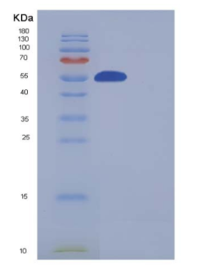 Recombinant Human SMYD3 / ZMYND1 Protein (His & FLAG tag),Recombinant Human SMYD3 / ZMYND1 Protein (His & FLAG tag)