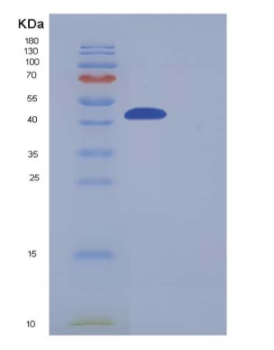 Recombinant Mouse Carboxypeptidase B1 / CPB1 Protein (His tag),Recombinant Mouse Carboxypeptidase B1 / CPB1 Protein (His tag)