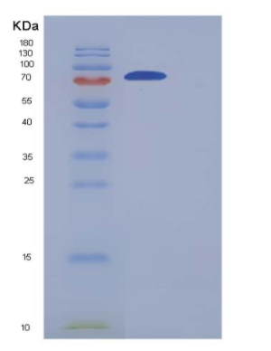Recombinant Human GLT25D2 Protein (His tag),Recombinant Human GLT25D2 Protein (His tag)