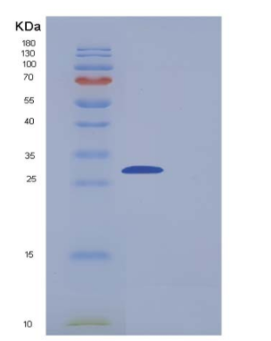 Recombinant Human Carbonic Anhydrase III / CA3 Protein (His tag),Recombinant Human Carbonic Anhydrase III / CA3 Protein (His tag)