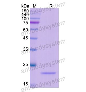 重组POU2F2蛋白,Recombinant Human POU2F2, N-His