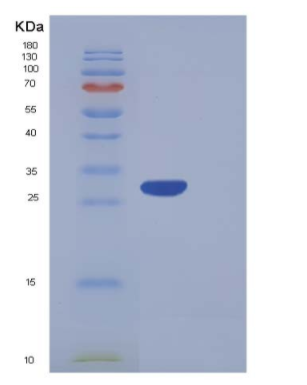 Recombinant Human CA5A / CA-VA Protein (His tag),Recombinant Human CA5A / CA-VA Protein (His tag)