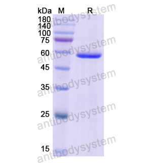 重组CELA3A蛋白,Recombinant Human CELA3A, N-GST