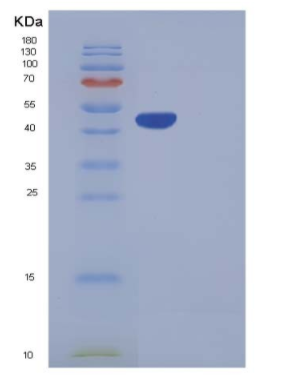 Recombinant Human Carboxypeptidase A2 / CPA2 Protein (His tag),Recombinant Human Carboxypeptidase A2 / CPA2 Protein (His tag)