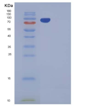 Recombinant Mouse CDCP1 Protein (Fc tag),Recombinant Mouse CDCP1 Protein (Fc tag)