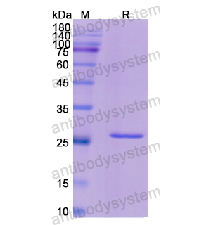 重组ACAA1蛋白,Recombinant Human ACAA1, N-His