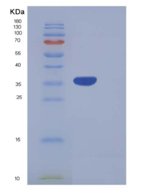Recombinant Human PRRG2 Protein (Fc Tag),Recombinant Human PRRG2 Protein (Fc Tag)