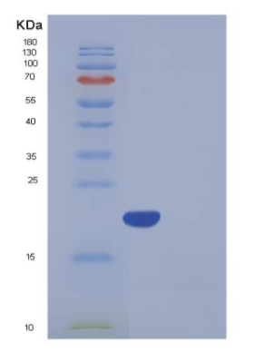 Recombinant Human BNIP3L Protein,Recombinant Human BNIP3L Protein