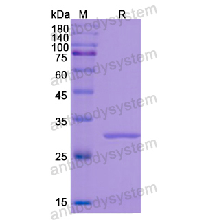 重组DBH蛋白,Recombinant Human DBH, N-His