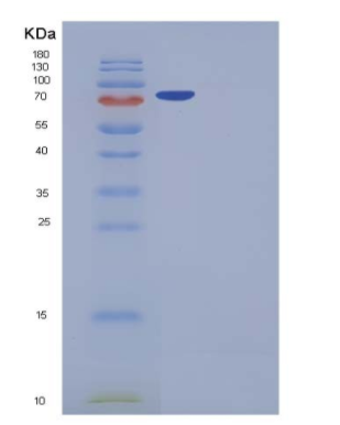 Recombinant Human DNMT2 / TRDMT1 Protein (GST tag),Recombinant Human DNMT2 / TRDMT1 Protein (GST tag)