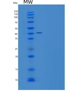 Recombinant Human NCR3 / NKp300 Protein (His & Fc tag),Recombinant Human NCR3 / NKp300 Protein (His & Fc tag)