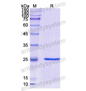 重組GSTP1蛋白,Recombinant Human GSTP1, N-His