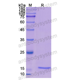 重組CST2蛋白,Recombinant Human CST2, N-His