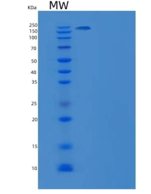 Recombinant Human XRCC5 & XRCC6 Heterodimer Protein,Recombinant Human XRCC5 & XRCC6 Heterodimer Protein