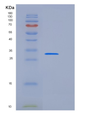 Recombinant Human LYPLA2 Protein (His Tag),Recombinant Human LYPLA2 Protein (His Tag)