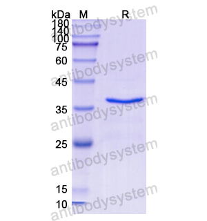 重组VIL1蛋白,Recombinant Human VIL1, N-His