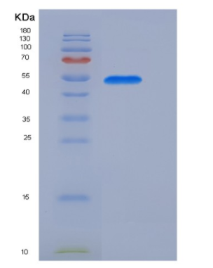 Recombinant Mouse Coagulation Factor IX / FIX / F9 Protein (His tag),Recombinant Mouse Coagulation Factor IX / FIX / F9 Protein (His tag)