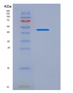 Recombinant Human PDK-1 Protein (His tag),Recombinant Human PDK-1 Protein (His tag)