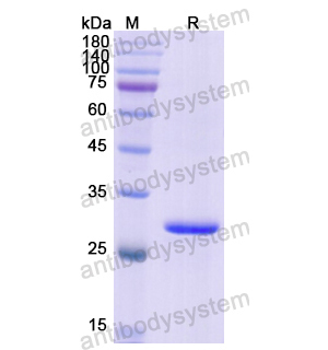 重组QDPR蛋白,Recombinant Human QDPR, N-His