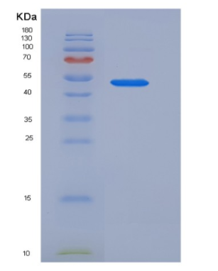 Recombinant Mouse SerpinA10 / ZPI Protein (His tag),Recombinant Mouse SerpinA10 / ZPI Protein (His tag)