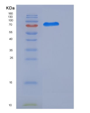 Recombinant Human CDK16 / PCTAIRE1 / PCTK1 Protein (GST tag),Recombinant Human CDK16 / PCTAIRE1 / PCTK1 Protein (GST tag)