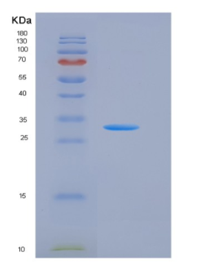 Recombinant Human NPC1 Protein (His & FLAG Tag),Recombinant Human NPC1 Protein (His & FLAG Tag)