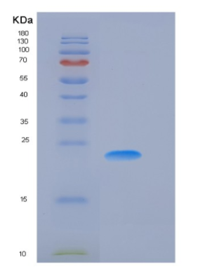 Recombinant Human CSRP1 Protein (His tag),Recombinant Human CSRP1 Protein (His tag)