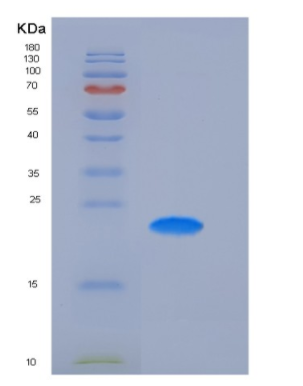 Recombinant Human CD32a / FCGR2A Protein (167 His, His tag),Recombinant Human CD32a / FCGR2A Protein (167 His, His tag)