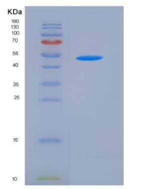 Recombinant Mouse KYNU / Kynureninase Protein (His tag),Recombinant Mouse KYNU / Kynureninase Protein (His tag)
