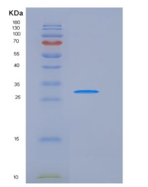 Recombinant Human Carbonic Anhydrase XIII / CA13 Protein (His tag),Recombinant Human Carbonic Anhydrase XIII / CA13 Protein (His tag)