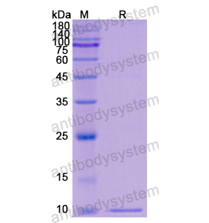 重组RBP1蛋白,Recombinant Human RBP1, N-His