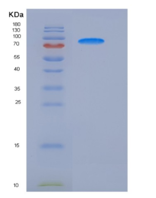 Recombinant Rat VEGFR2 / Flk-1 / CD309 / KDR Protein (His tag),Recombinant Rat VEGFR2 / Flk-1 / CD309 / KDR Protein (His tag)