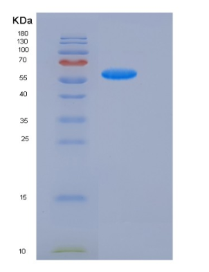 Recombinant Human PSAP / Prosaposin Protein (His Tag),Recombinant Human PSAP / Prosaposin Protein (His Tag)