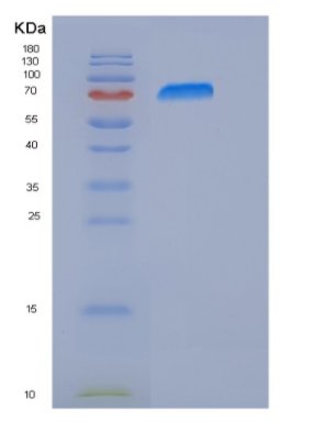 Recombinant Human PARP-3 / PARP3 Protein (His & GST tag),Recombinant Human PARP-3 / PARP3 Protein (His & GST tag)