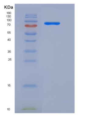 Recombinant Human AKT3 Protein (GST tag),Recombinant Human AKT3 Protein (GST tag)