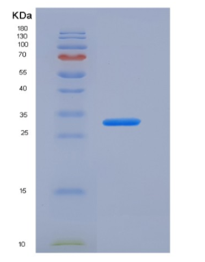 Recombinant Human Carbonic Anhydrase XIV / CA14 Protein (His tag),Recombinant Human Carbonic Anhydrase XIV / CA14 Protein (His tag)