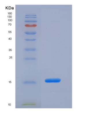 Recombinant Mouse MOG (aa30-149) Protein (His tag),Recombinant Mouse MOG (aa30-149) Protein (His tag)