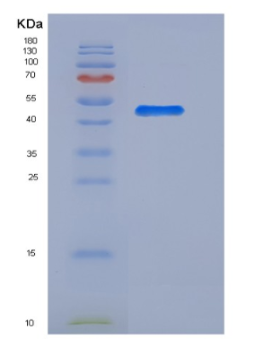 Recombinant Rat Angiotensinogen / SerpinA8 / AGT Protein (His Tag),Recombinant Rat Angiotensinogen / SerpinA8 / AGT Protein (His Tag)