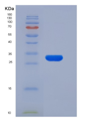 Recombinant Rat CTRB1 / Chymotrypsinogen B1 Protein (His Tag),Recombinant Rat CTRB1 / Chymotrypsinogen B1 Protein (His Tag)