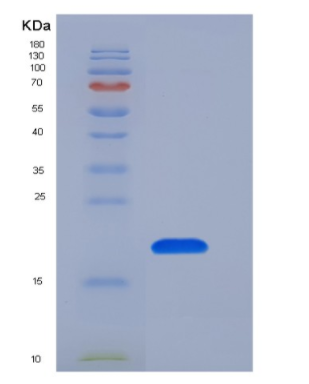 Recombinant Human GKN1 / Gastrokine 1 Protein (His tag),Recombinant Human GKN1 / Gastrokine 1 Protein (His tag)