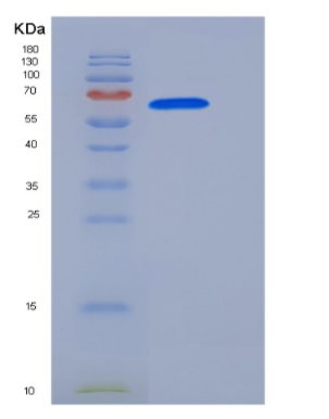 Recombinant Human FAM20C / DMP4 Protein (His Tag),Recombinant Human FAM20C / DMP4 Protein (His Tag)