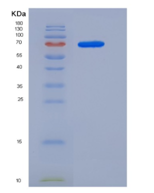 Recombinant Mouse MEK1 / MAP2K1 / MKK1 Protein (His & GST tag),Recombinant Mouse MEK1 / MAP2K1 / MKK1 Protein (His & GST tag)