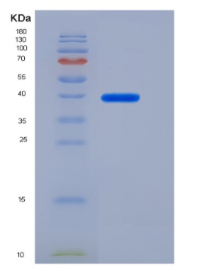 Recombinant Rat IL-6R / CD126 Protein (ECD, His tag),Recombinant Rat IL-6R / CD126 Protein (ECD, His tag)