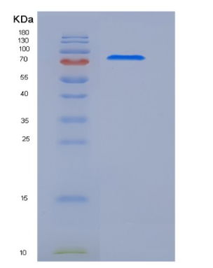 Recombinant Human MEGF10 Protein (His Tag),Recombinant Human MEGF10 Protein (His Tag)