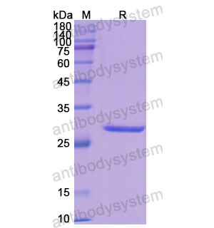 重组GSTM1蛋白,Recombinant Human GSTM1, N-His