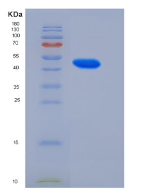 Recombinant Human GADD45A / DDIT-1 Protein (His & GST tag),Recombinant Human GADD45A / DDIT-1 Protein (His & GST tag)