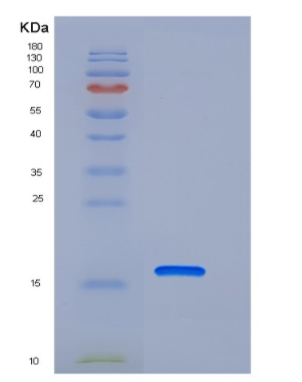 Recombinant Human PDZD11 / PDZK11 / PISP Protein (His tag),Recombinant Human PDZD11 / PDZK11 / PISP Protein (His tag)