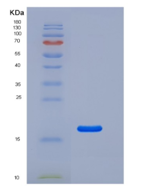 Recombinant Human CD69 Protein (His tag),Recombinant Human CD69 Protein (His tag)