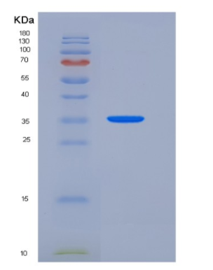 Recombinant Mouse ACP5 / TRAP Protein (His tag),Recombinant Mouse ACP5 / TRAP Protein (His tag)
